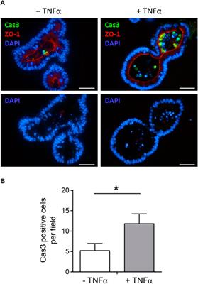 Time-dependent effects of tumor necrosis factor α on Ca2+-dependent secretion in murine small intestinal organoids
